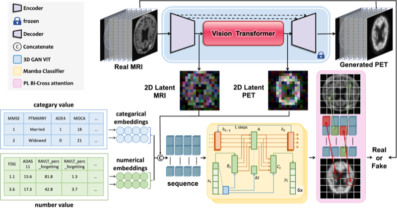 GFE-Mamba multimodal progression assessment framework