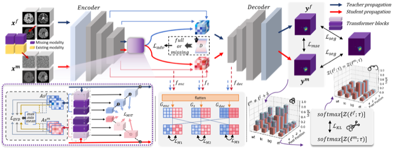 MST-KDNet framework for brain tumor segmentation with missing modalities